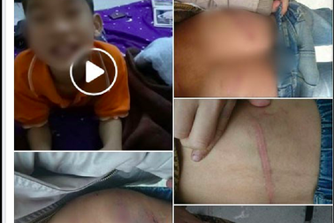 Chủ tịch Hà Nội yêu cầu làm rõ vụ bố đẻ đánh tím người con trai