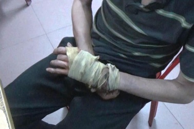 Giả tàn tật xin tiền để chích ma túy