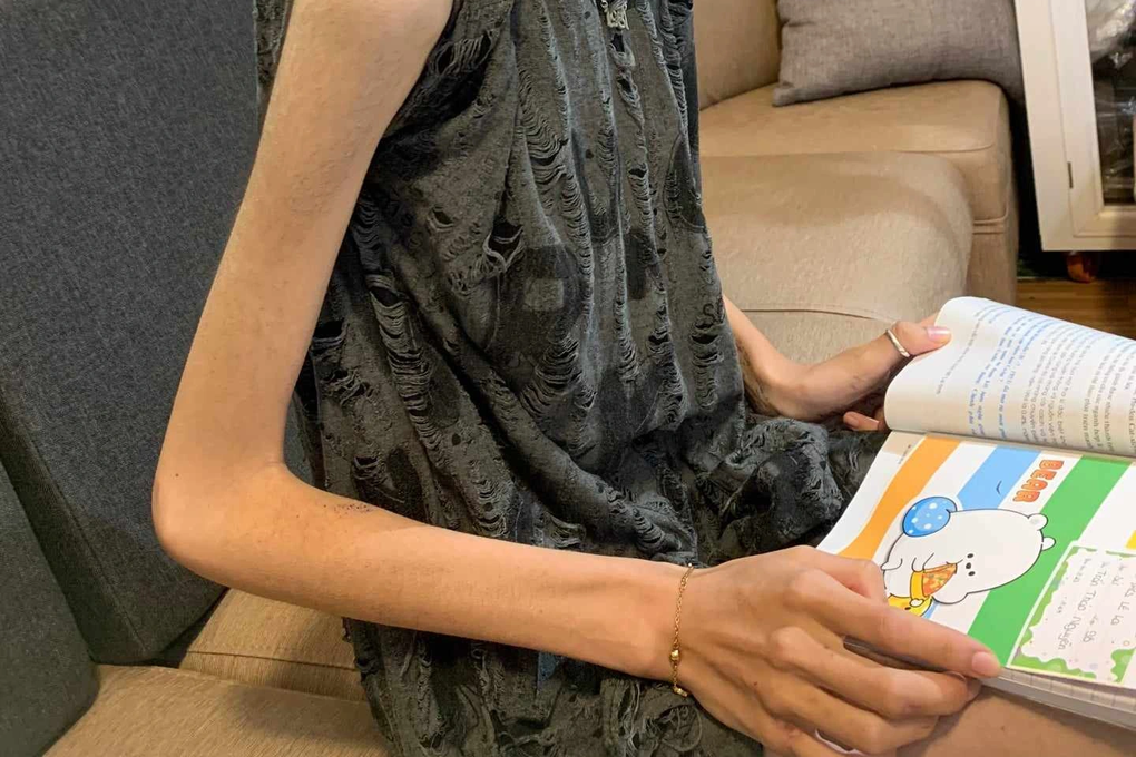 Ám ảnh bị cô giáo mắng không có não, nữ sinh stress, sụt cả chục cân? - 3