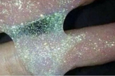 Bơm nhũ vào vùng kín: Xu hướng thời trang mới ẩn chứa nhiều rủi ro