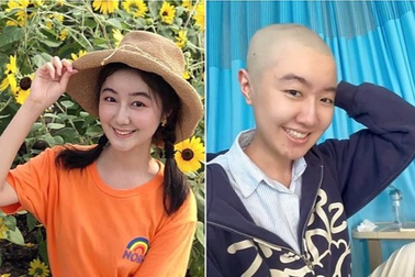 "Sao nhí" Trung Quốc đăng ảnh xuống tóc vì ung thư, được fan ủng hộ