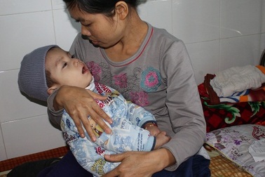 Bé 2 tuổi bị rối loạn chuyển hóa bẩm sinh đã không còn