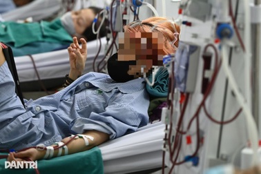 Chưa 30 đã suy thận vì dành cả thanh xuân làm thêm giờ, ăn hàng quán