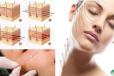 Nâng cơ mặt bằng chỉ với chuyên gia Hàn Quốc