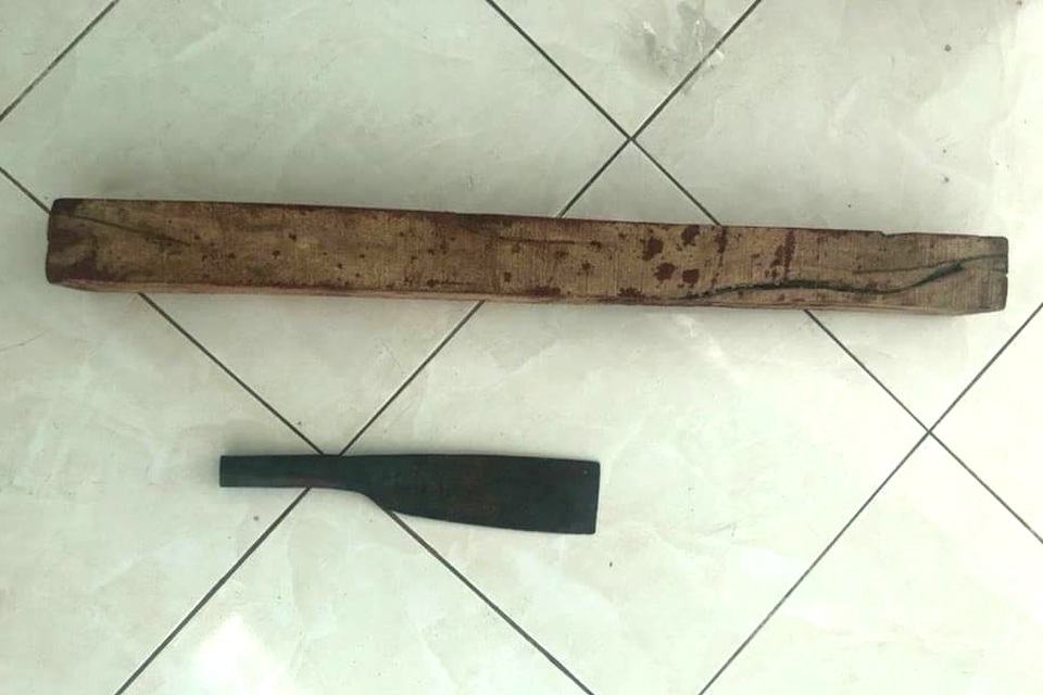 Bị la mắng vì nhậu say, con trai cầm dao chém cha nguy kịch - 2 Bị la mắng vì nhậu say, con trai cầm dao chém cha nguy kịch - 2