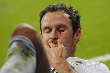 Carvalho đổ máu sau trận derby Madrid