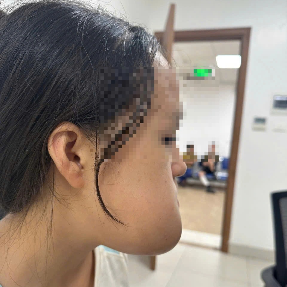 Sau 9 giờ phẫu thuật, bác sĩ giải cứu thiếu nữ khỏi khối u khổng lồ ở mặt - 1