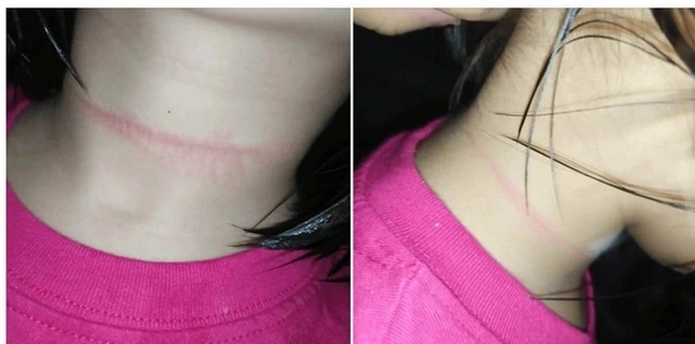 Bé gái 11 tuổi thiệt mạng vì làm theo thử thách lan truyền trên TikTok - 3 Bé gái 11 tuổi thiệt mạng vì làm theo thử thách lan truyền trên TikTok - 3