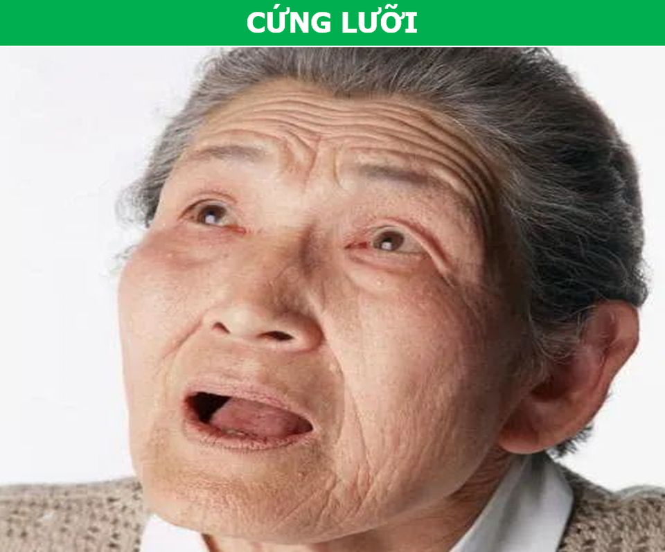 Hiện tượng “1 mềm, 2 cứng” cảnh báo bệnh nguy hiểm thường gặp trong mùa hè - 4 Hiện tượng “1 mềm, 2 cứng” cảnh báo bệnh nguy hiểm thường gặp trong mùa hè - 4