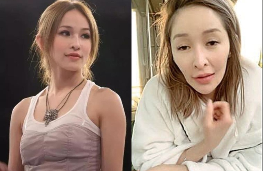 Chị đẹp U50 bị hủy dung nhan vì chó cắn, tiết lộ lý do chưa lập gia đình - 3 Chị đẹp U50 bị hủy dung nhan vì chó cắn, tiết lộ lý do chưa lập gia đình - 3