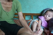 Người đàn bà mơ ước được... cắt bỏ chân