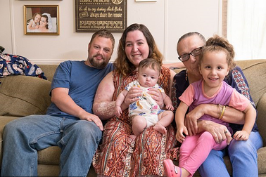 Tình yêu đáng ngưỡng mộ của cô gái trẻ bị vảy nến che kín 90% cơ thể