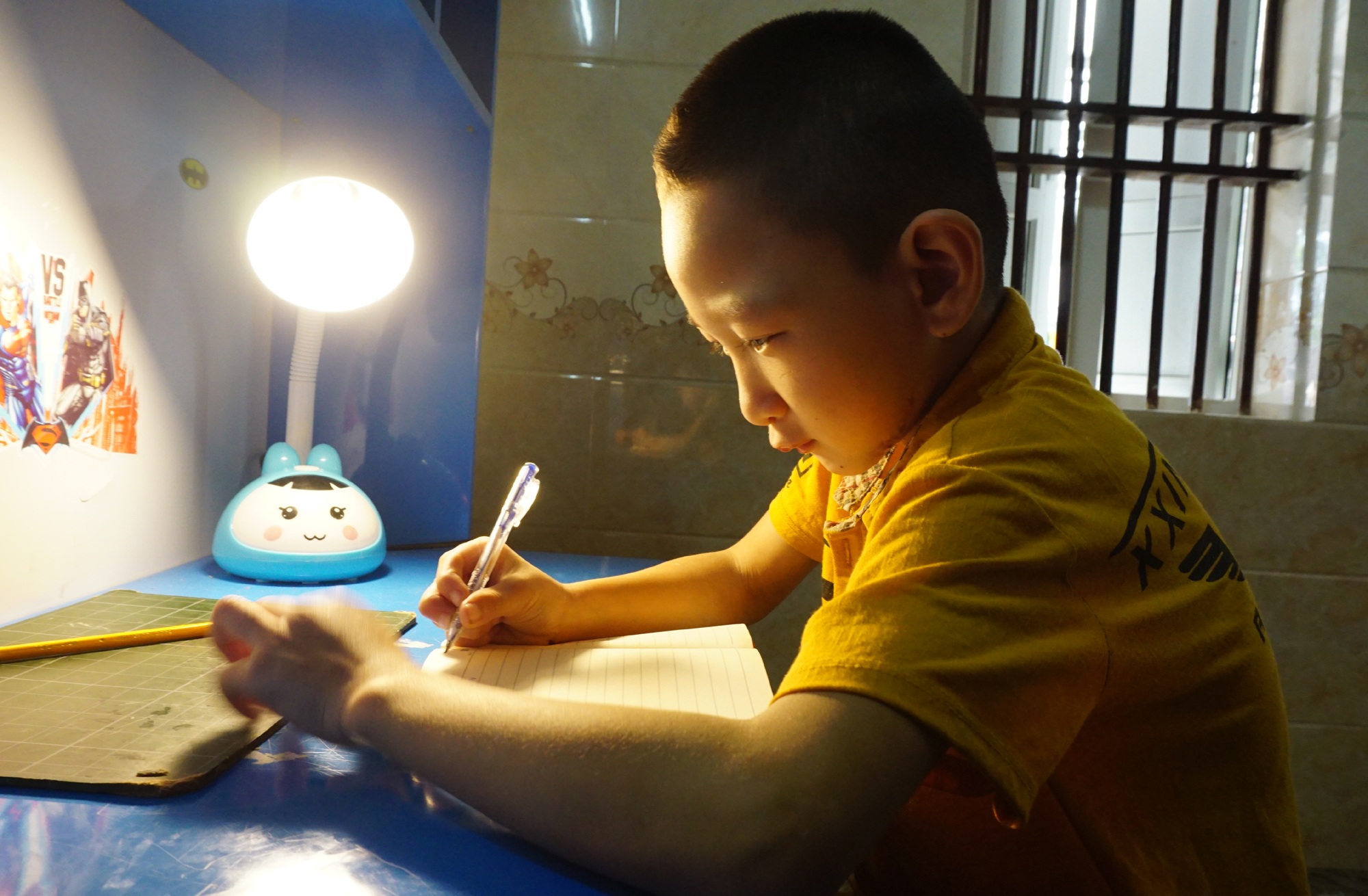 Hành trình hồi sinh đầy gian nan của cậu bé đa dị tật 2 lần bị bỏ rơi - 6 Hành trình hồi sinh đầy gian nan của cậu bé đa dị tật 2 lần bị bỏ rơi - 6