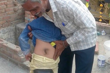 Mọc nhúm lông ở lưng, cậu bé được cả làng tôn kính như thần