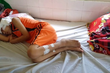 Người con thứ hai của chị Nga, cháu Phan Văn Đô đang nằm điều trị tại Trung tâm Nhi khoa, Bệnh viện Trung ương Huế