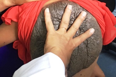 Những căn bệnh lạ cực kỳ hiếm gặp ở Việt Nam