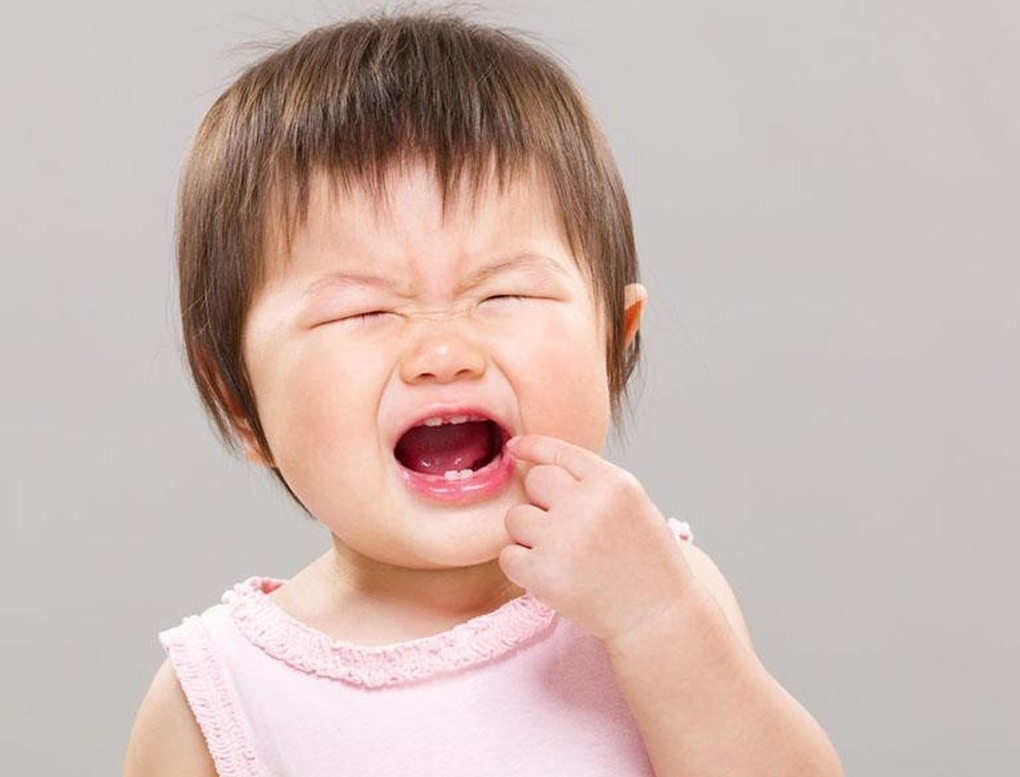 Mảng bám - thủ phạm gây sâu răng sữa ở trẻ - 3 Mảng bám - thủ phạm gây sâu răng sữa ở trẻ - 3