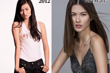 “Phẫu thuật thẩm mỹ không hẳn xấu, nhưng đừng đẹp 9 rưỡi lại đòi 10”