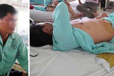 Rộ chuyện vợ bạo hành chồng: Đòn độc của “phái yếu”