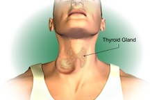 Triệu chứng ung thư tuyến giáp