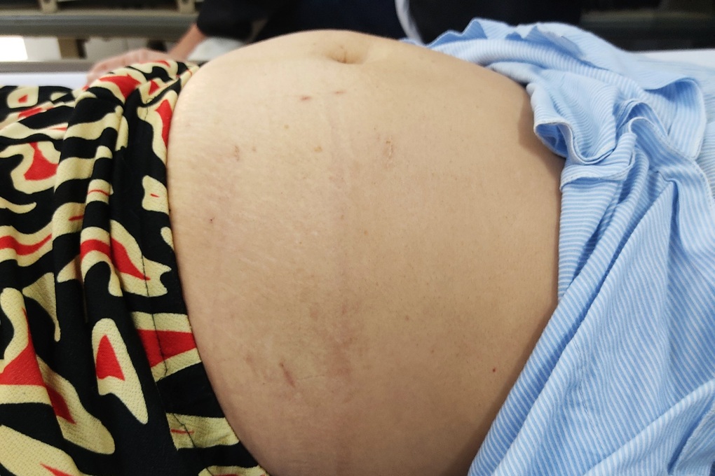 Người phụ nữ 15 năm cầu cứu khắp các bệnh viện vì nhiễm ký sinh trùng ở chó - 1 Người phụ nữ 15 năm cầu cứu khắp các bệnh viện vì nhiễm ký sinh trùng ở chó - 1