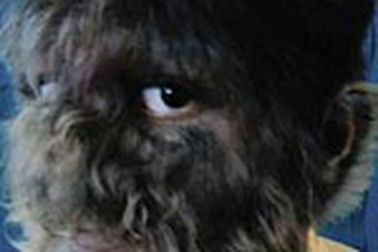 “Cậu bé ma sói” ở Ấn Độ