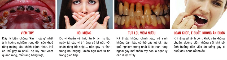 Phục hình răng sứ thẩm mỹ tại Dora có đáng lo ngại? - 1 Phục hình răng sứ thẩm mỹ tại Dora có đáng lo ngại? - 1