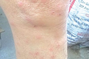 Côn trùng lạ tấn công người dân