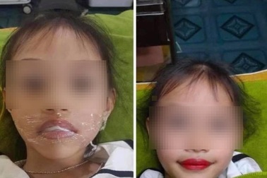 Bé gái 5 tuổi đã xăm môi: Hệ lụy khi cho trẻ làm đẹp quá sớm