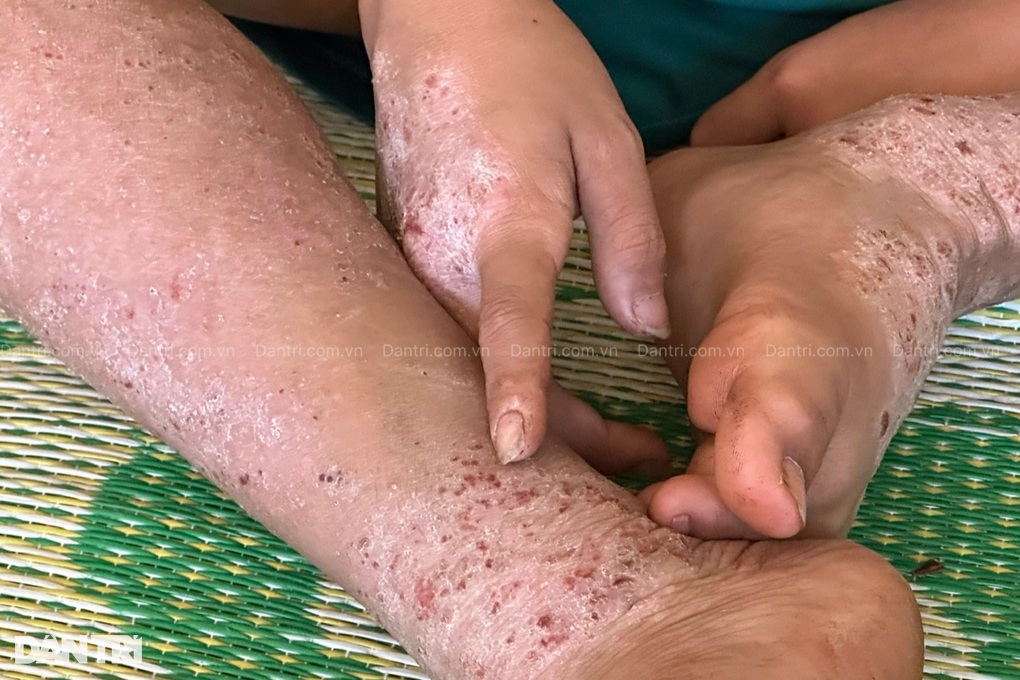 Giá như mẹ có thể chịu thay con những nỗi đau này! - 2 Giá như mẹ có thể chịu thay con những nỗi đau này! - 2
