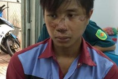 Khởi tố đối tượng giết người sau va quẹt giao thông