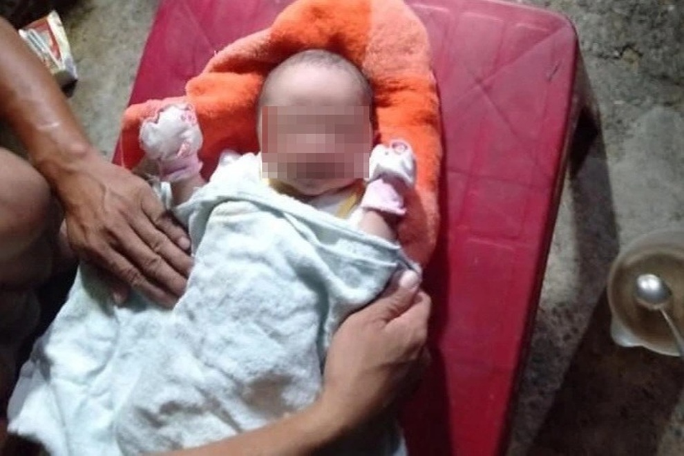 Bé sơ sinh bị bỏ rơi với nhiều vết côn trùng cắn - 1 Bé sơ sinh bị bỏ rơi với nhiều vết côn trùng cắn - 1