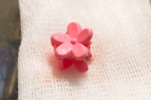 Bé gái ra dịch mủ âm đạo 6 tháng trời vì thứ không ngờ mắc kẹt ở vùng kín