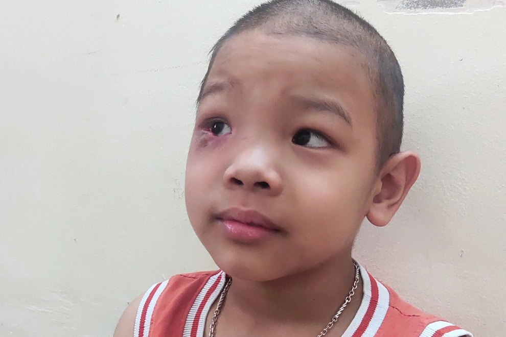 Cậu bé 7 tuổi tái ung thư: Mẹ vào thuốc... con mới sống được - 1 Cậu bé 7 tuổi tái ung thư: Mẹ vào thuốc... con mới sống được - 1