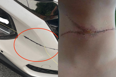 Hà Nội: Dây diều "sắc như dao" cứa ngang cổ người, chém đứt đầu xe ô tô