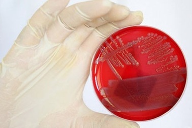 Vi khuẩn gây bệnh có thể sống một tuần trên máy bay