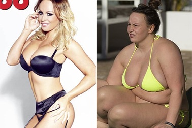 Người mẫu Chanelle Hayes cắt bớt 80% dạ dày sau khi nặng 110 kg
