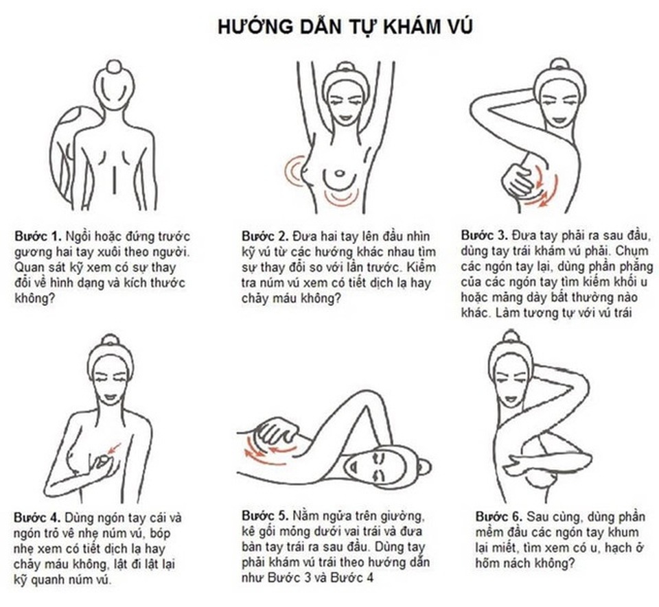 Những điều cần biết về bệnh ung thư phổ biến nhất ở nữ giới - 2 Những điều cần biết về bệnh ung thư phổ biến nhất ở nữ giới - 2