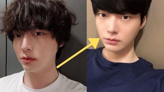 Chồng cũ của Goo Hye Sun sụt 10kg trong 2 tháng