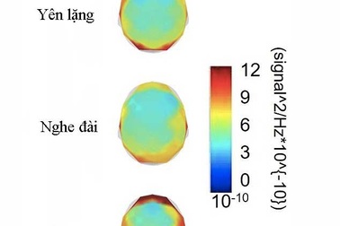 Tại sao nên nghe nhạc khi tập gym?