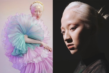 Nữ sinh bạch tạng thành mẫu ảnh đắt khách