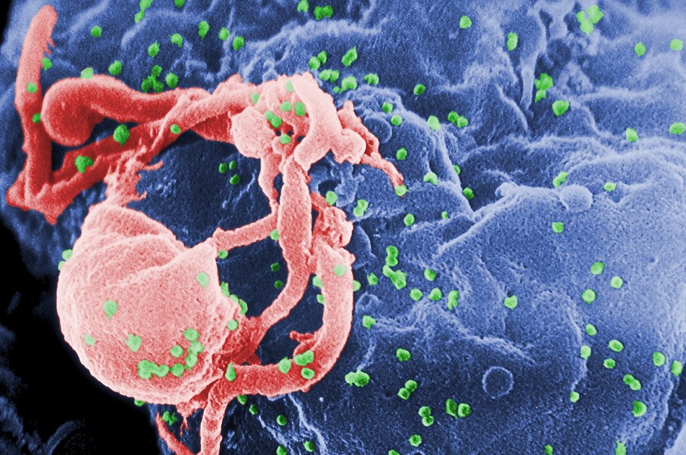 Người thứ 7 khỏi HIV: Sắp tới chương cuối của căn bệnh thế kỷ? - 3 Người thứ 7 khỏi HIV: Sắp tới chương cuối của căn bệnh thế kỷ? - 3