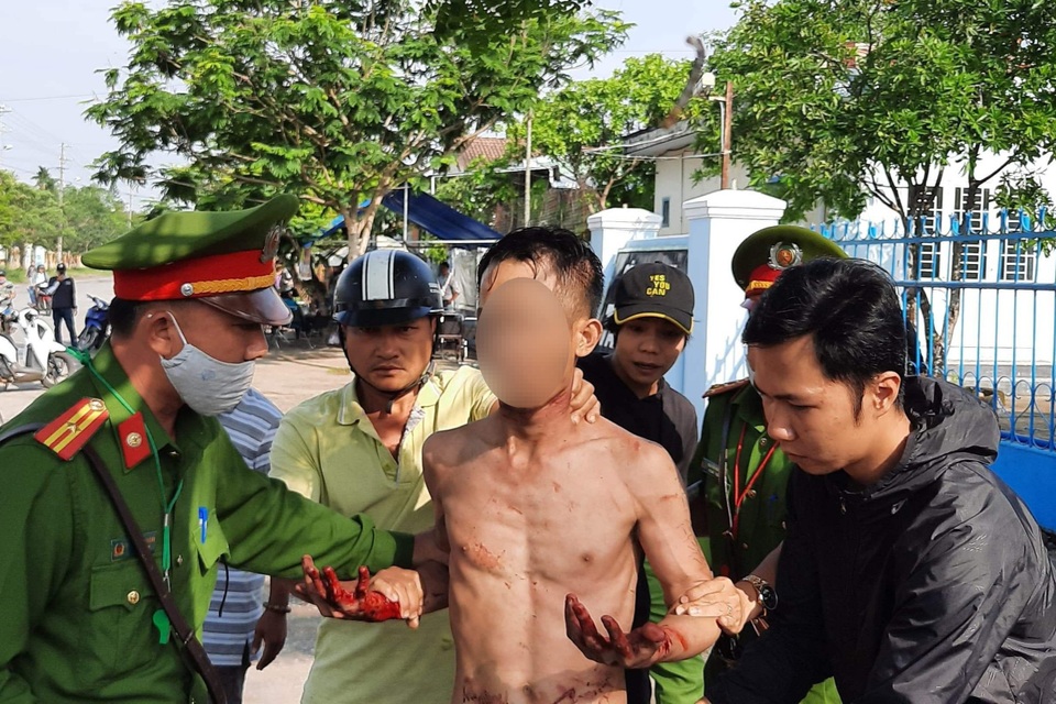 Nam thanh niên cầm dao tự cắt cổ, miệng liên tục la hét giết người - 1 Nam thanh niên cầm dao tự cắt cổ, miệng liên tục la hét giết người - 1