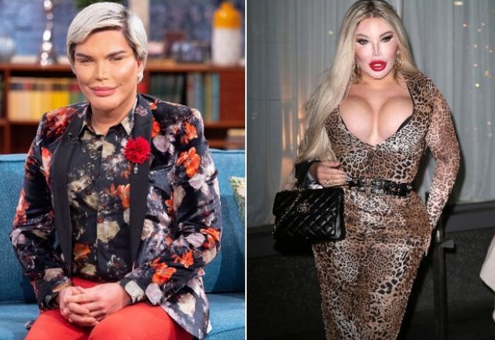 Sau khi chuyển giới, Jessica Alves lộ mặt sưng phồng vì thẩm mỹ - 2 Sau khi chuyển giới, Jessica Alves lộ mặt sưng phồng vì thẩm mỹ - 2