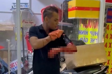 Nam nhân viên giữ xe quán nhậu bị khách chém ở TPHCM