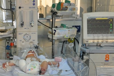 Thai nhi bị xe cán văng khỏi bụng mẹ phải thở máy trở lại