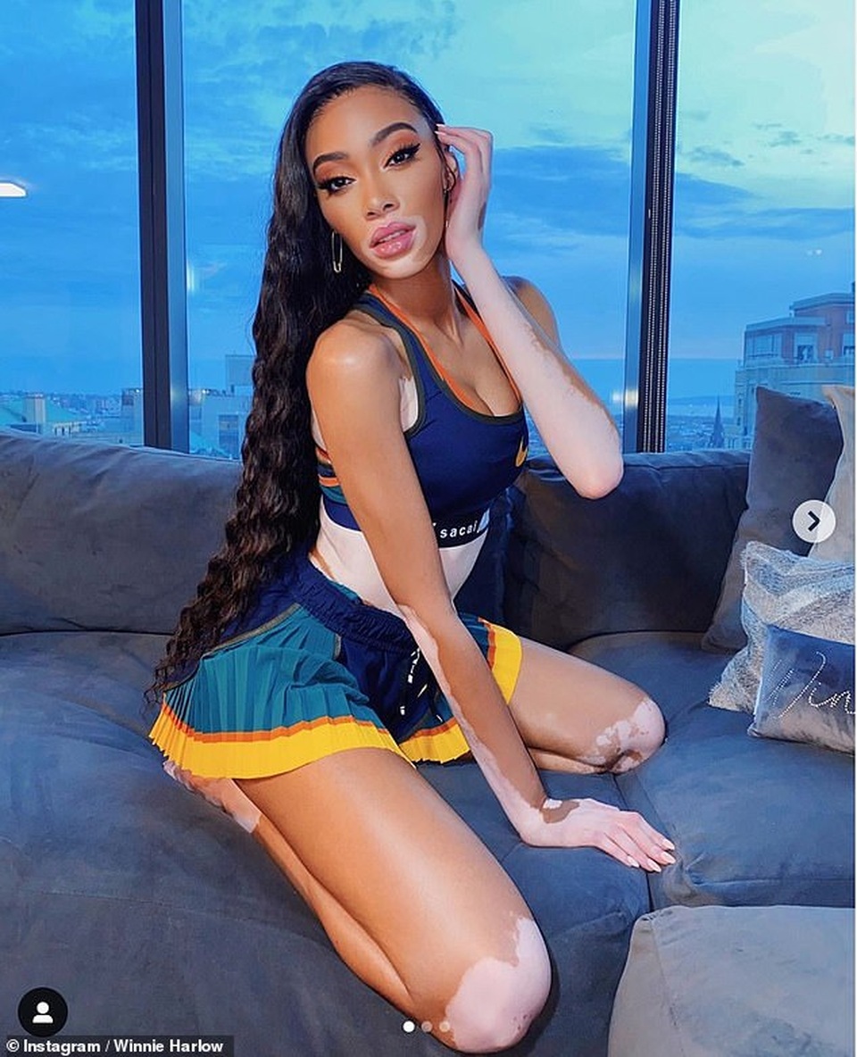 Holly Hagan thon thả đáng kinh ngạc sau khi giảm 7kg - 6