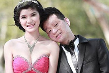 Chuyện tình đáng ngưỡng mộ “chồng xấu - vợ xinh” gây sốt trên mạng