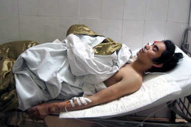 Vụ sập giàn giáo cao ốc qua lời kể của nạn nhân