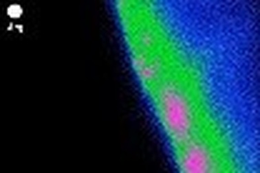 Xác định được các tế bào kiểm soát cảm giác thèm ăn trong não